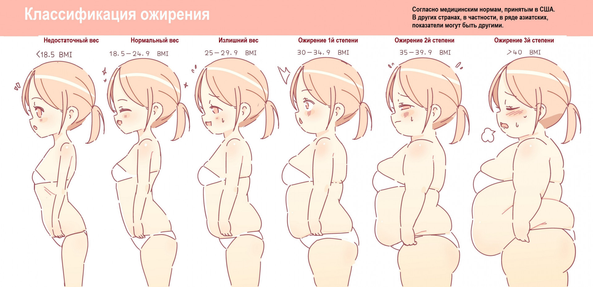 Классификация ожирения